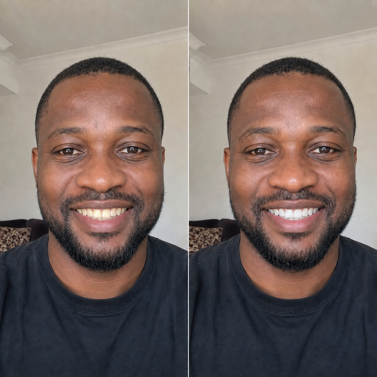 Avis de Fabrice N. sur Smile Kit