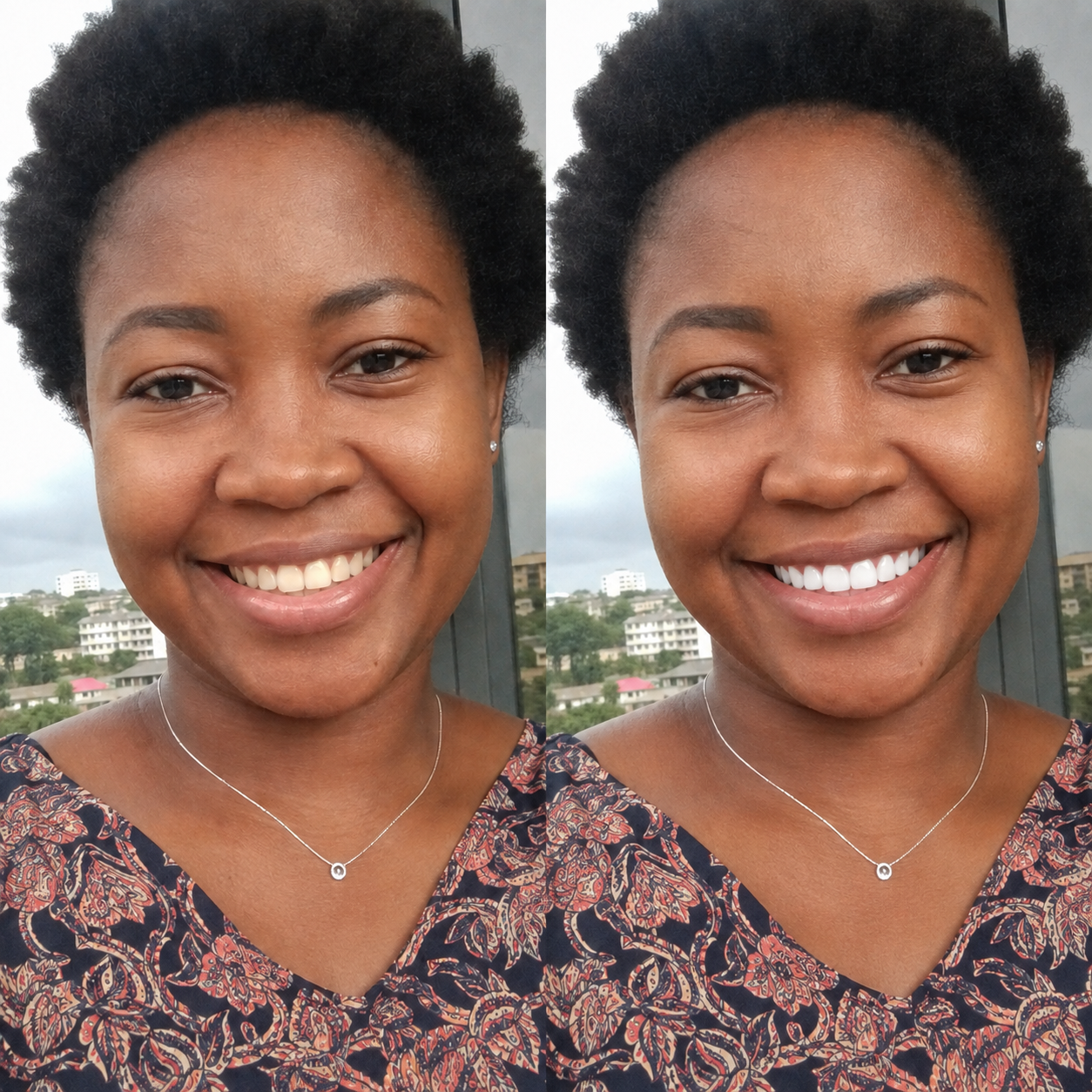 Avis de Mariam D. sur Smile Kit