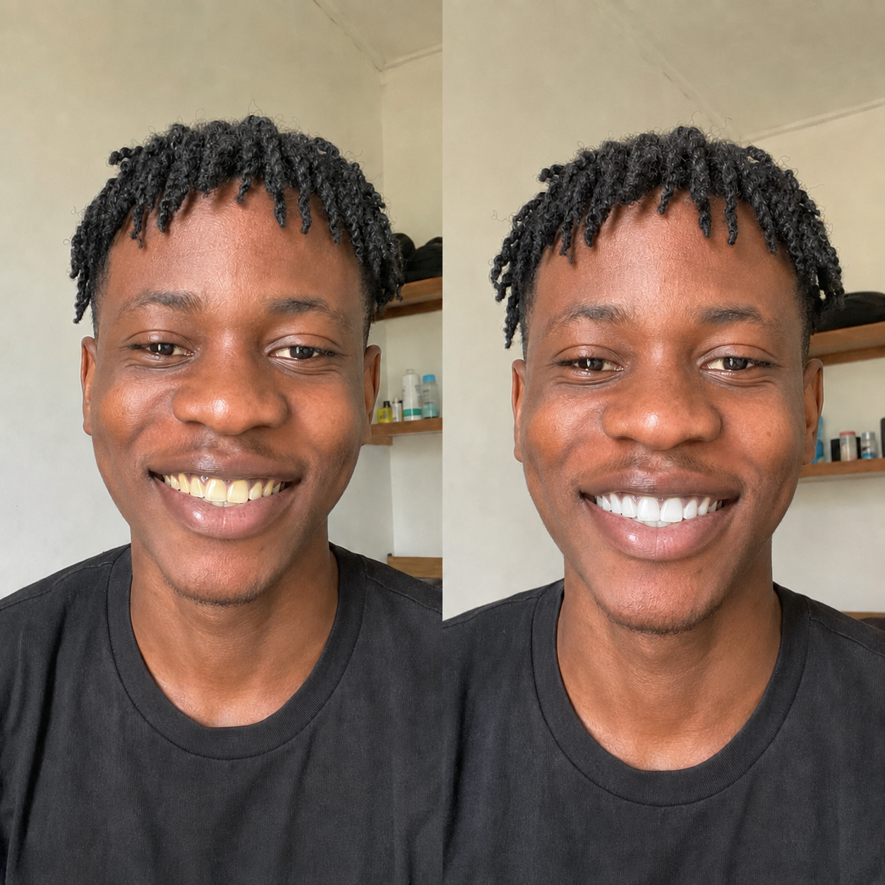 Avis de Kévin A. sur Smile Kit
