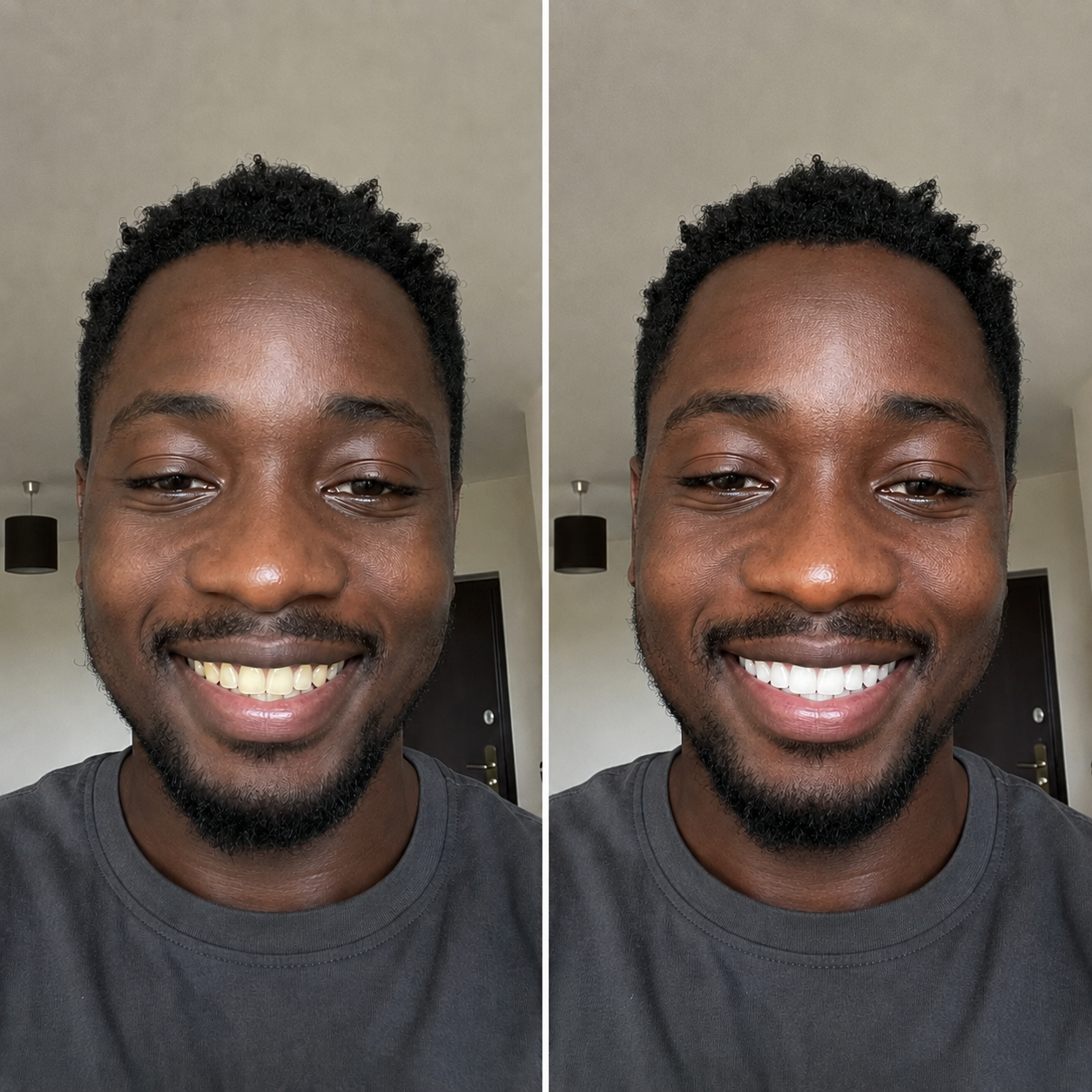 Avis de Wilfried K. sur Smile Kit