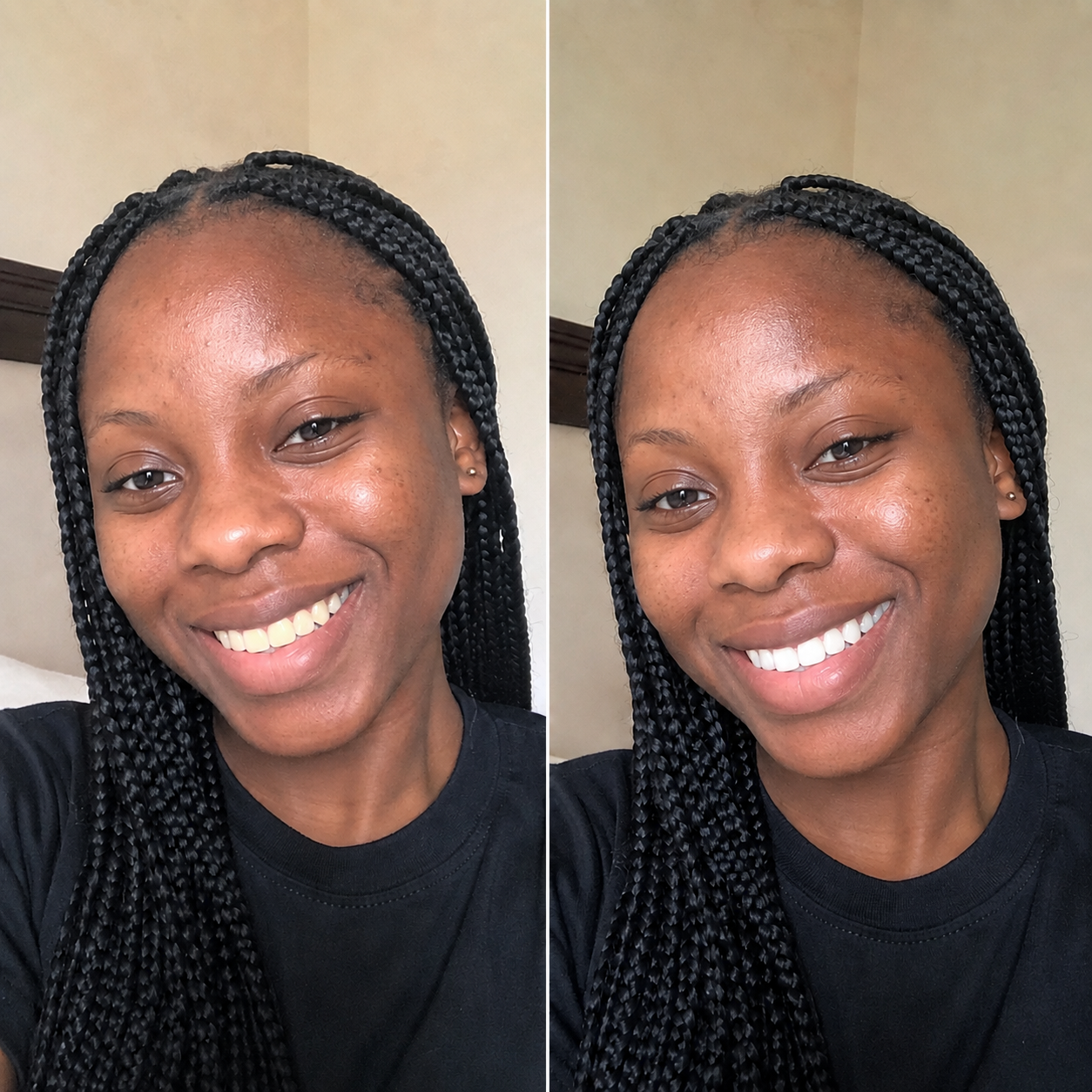Avis de Aïcha B. sur Smile Kit