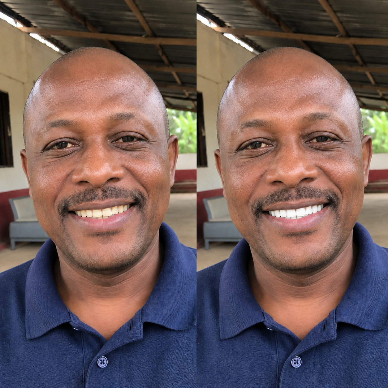 Avis de Serge K. sur Smile Kit