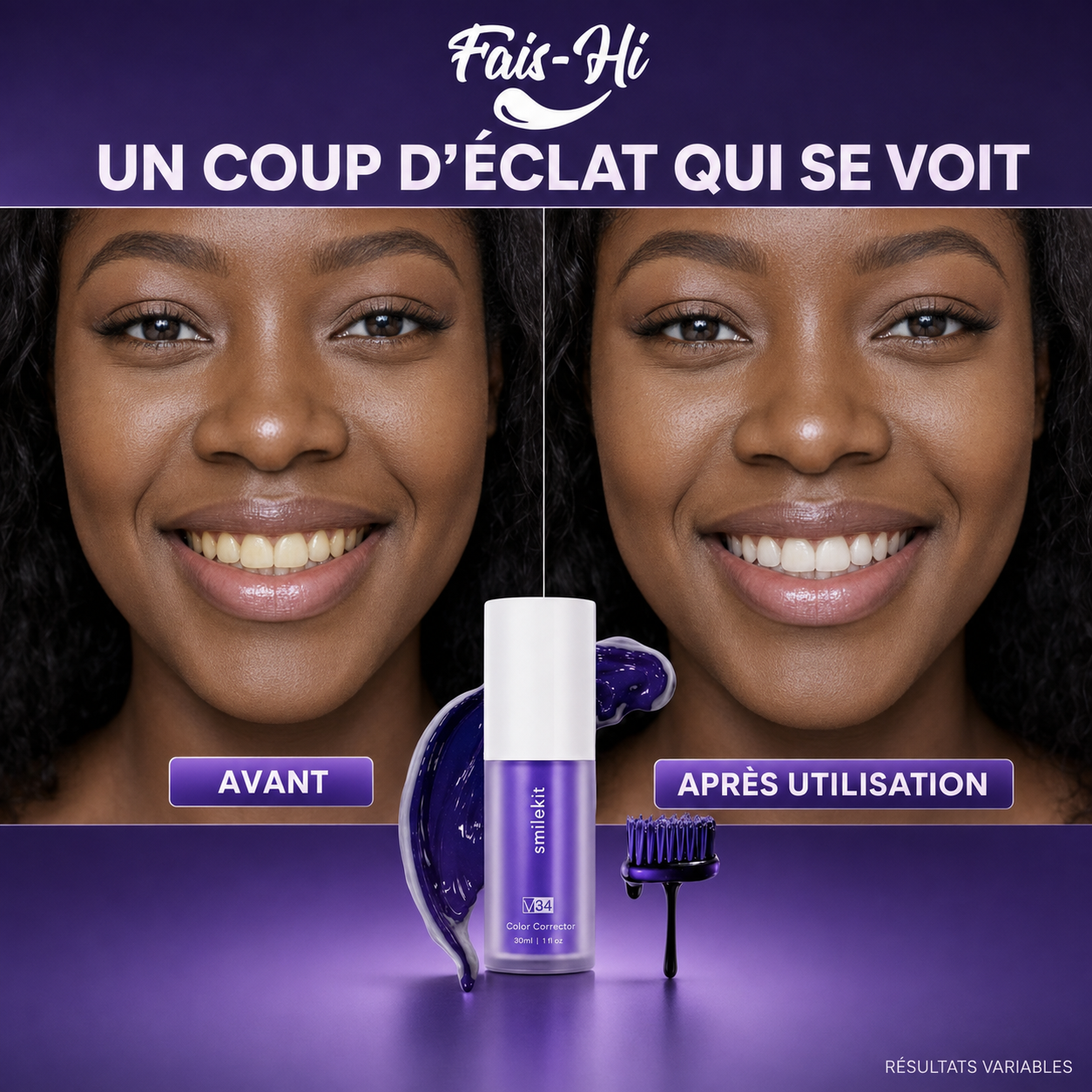 Smile Kit Fais-Hi – avant et après